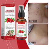 Rosehip Seed And Wart Essence Oil, Moisturizes And Restores Smooth Skin - V.I.P Digital Presence