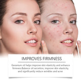 Retinol Essence Oil, Repair Facial Acne Skin Nourishing Elastic Hydrating Moisturizing Skin Care Essence
