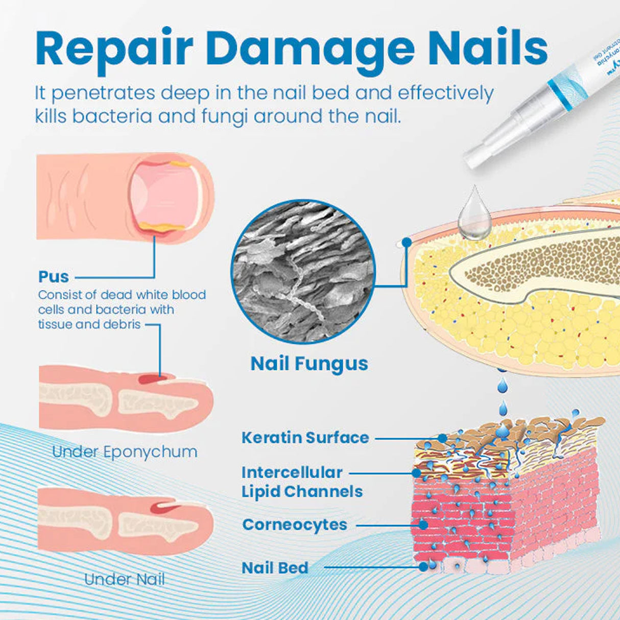 Anti-Paronychia Nail Repairing Gel, Repair Encased Rotten Nails Soft Nails Thickening Pain Relief Cleansing Care - V.I.P Digital Presence
