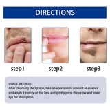 EAST MOON Lip Essence Rolling Lotion, Moisturize And Fade Lip Lines, Prevent Dry Crack And Dead Skin, Plump And Moisturize Lips - V.I.P Digital Presence