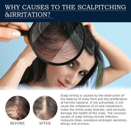 Scalp Treatment Essence Spray, Hair Care And Repair Damaged Hair Follicle Hair Root Treatment Spray - V.I.P Digital Presence