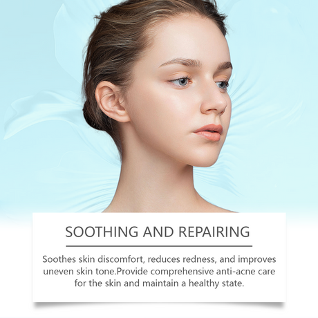 Azelaic Acid Acne Cream, Oil Control Gentle Moisturizing Acne Skin Moisturizing Daily Facial Cream - V.I.P Digital Presence