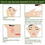 Aceite esencial de árbol de té, reparador del acné, reduce los poros, hidratante, cuidado facial.