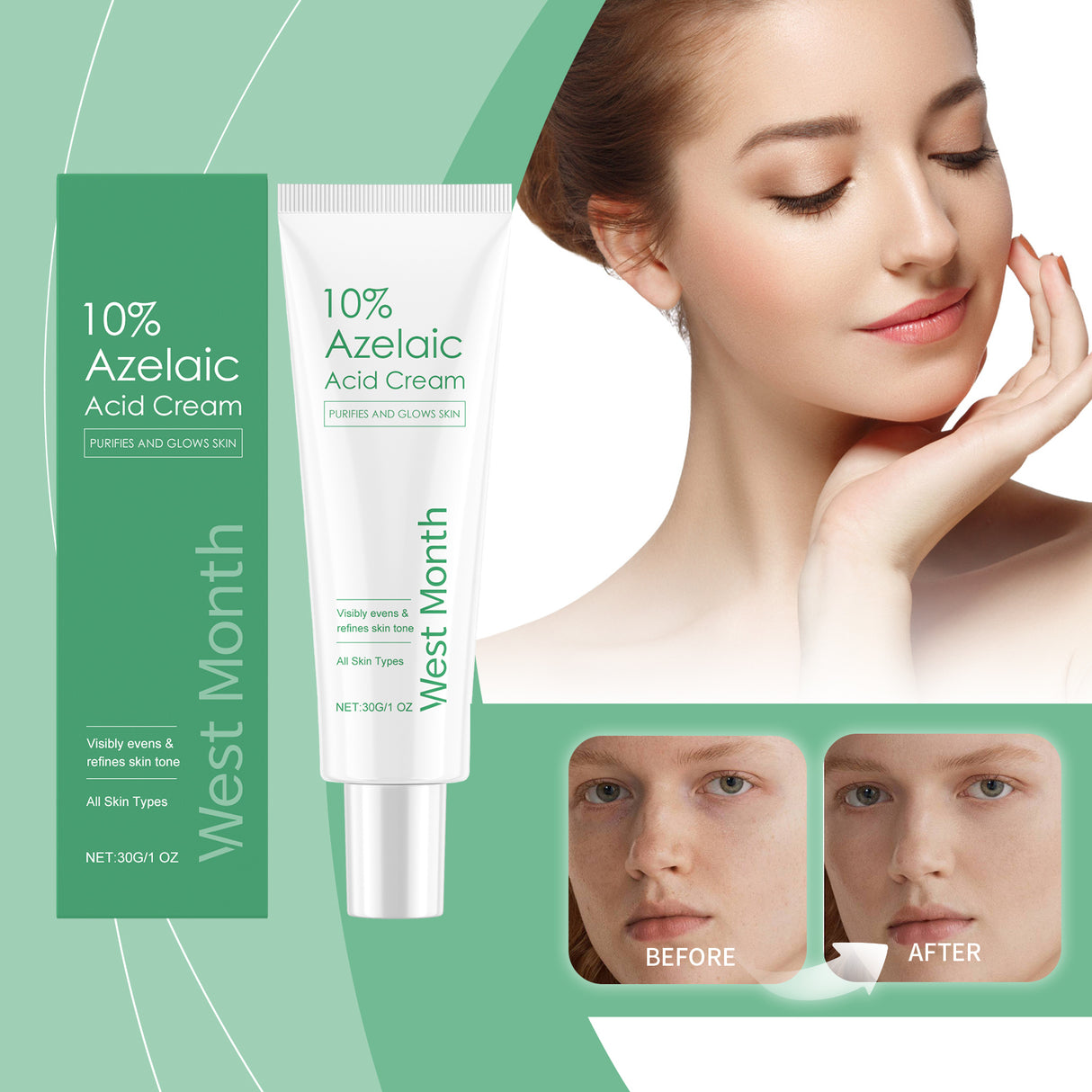 Crema hidratante reparadora con ácido azelaico, control de grasa facial, suave y refrescante.