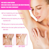 Whitening Cream, Whitening And Brightens Skin, Moisturizes And Removes Blackness Beauty Skin Cream - V.I.P Digital Presence