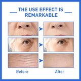 Anti-Aging Collagen Serum with Nicotinamide, Vitamin C, Hyaluronic Acid - Reduce Dark Spots, Cleanse & Tighten Skin - V.I.P Digital Presence