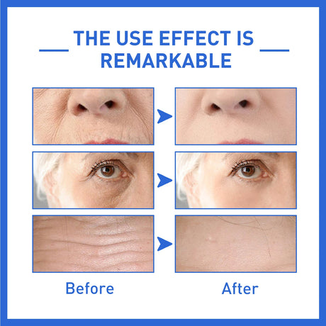 Anti-Aging Collagen Serum with Nicotinamide, Vitamin C, Hyaluronic Acid - Reduce Dark Spots, Cleanse & Tighten Skin - V.I.P Digital Presence