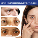 Tea Tree Hexapeptide Firming Eye Cream, Eye Care Cream To Reduce Fine Lines And Repair Eye Skin - V.I.P Digital Presence