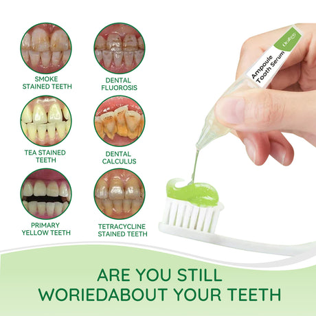 Teeth Whitening Serum, Deep Cleaning Mouth Stains Yellow Care Teeth Whitening Teeth - V.I.P Digital Presence