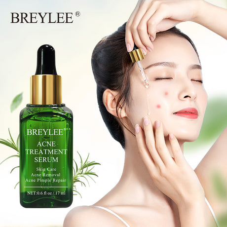 BREYLEE Acne Treatment Face Serum Mask Anti Acne Pimple Scar Remover Moisturizing Whitening Skin Care Facial Essence Cream 17ml - V.I.P Digital Presence