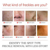 Pigment Repair Cream, Moisturizing And Lightening Freckles Dark Spots Spots Melasma Melanin Beauty Cream - V.I.P Digital Presence