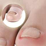 Silicone Inlay Nail Corrector Roll Nail To Correct Nail Pad Nail Groove And Toe To Prevent Nails From Growing Into Flesh - V.I.P Digital Presence