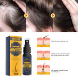Dense Castor Oil Nutrient Solution, Hair Prevention, Moisturizing Hair Follicles Massage Repair Hair Hair - V.I.P Digital Presence