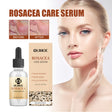 Erythematous Repair Essence, Repair Skin Lighten Facial Erythematous Moisturizing Essential Oil - V.I.P Digital Presence