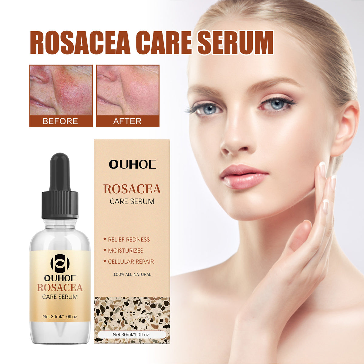 Erythematous Repair Essence, Repair Skin Lighten Facial Erythematous Moisturizing Essential Oil - V.I.P Digital Presence