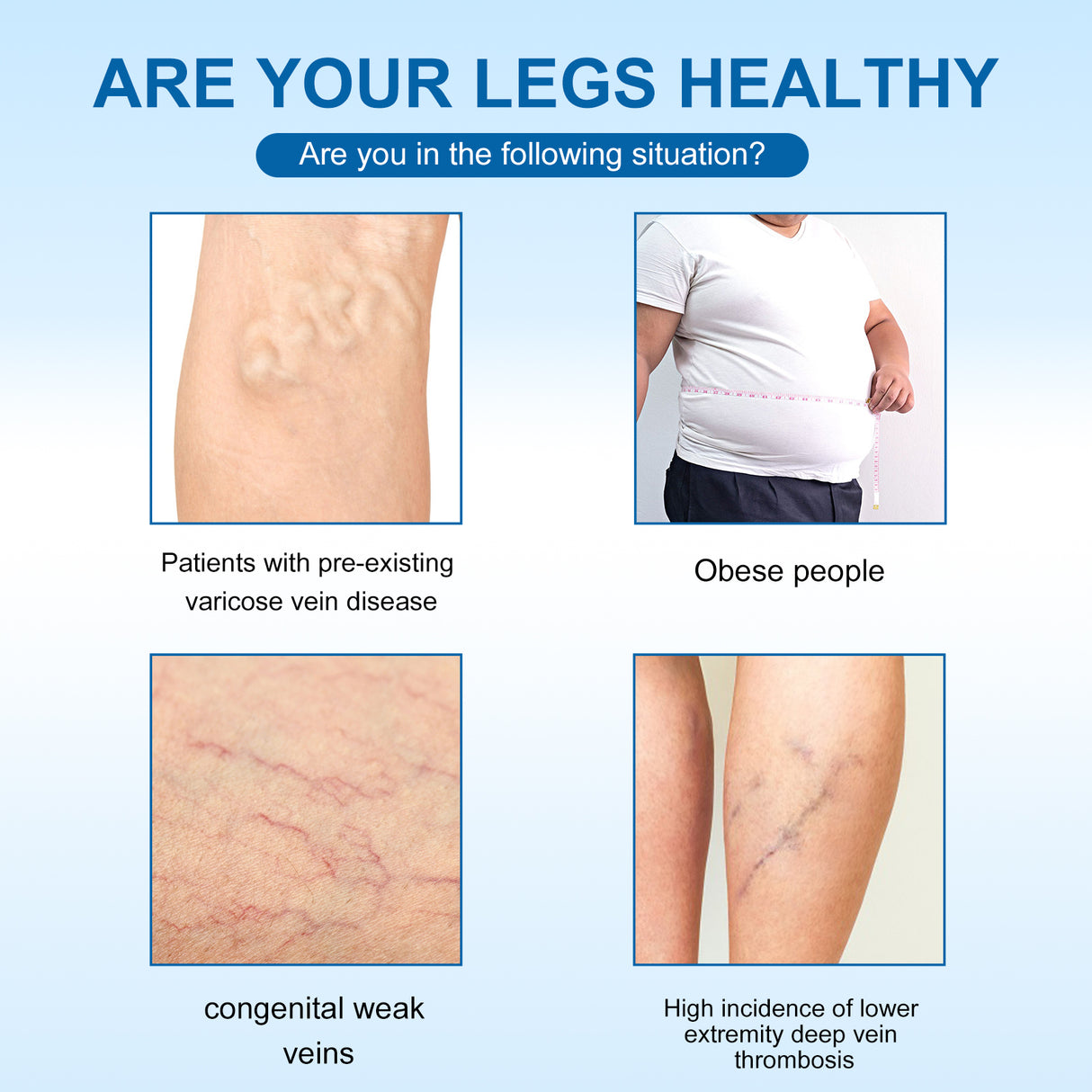 Varicose Vein Slimming Cream, Vein Repair Body Care Reduces Leg Muscle Swelling Earthworm Leg Slimming Cream - V.I.P Digital Presence