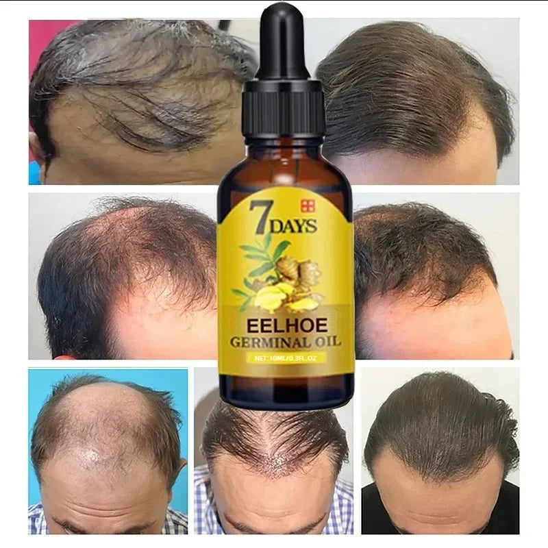 7 Day Fast Hair Growth Oil Ginger Growth Hair Treatment Anti Hair Loss Men Women Scalp Treatment Serum Products Beauty Product - V.I.P Digital Presence
