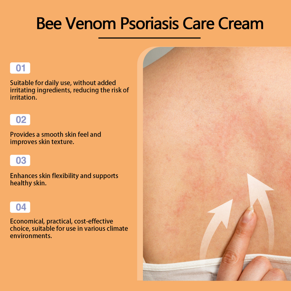 Bee-Venom Cowhide Moss Care Cream Moisturizes And Restores Itchy Red And Swollen Hands And Feet Skin Care Cream - V.I.P Digital Presence