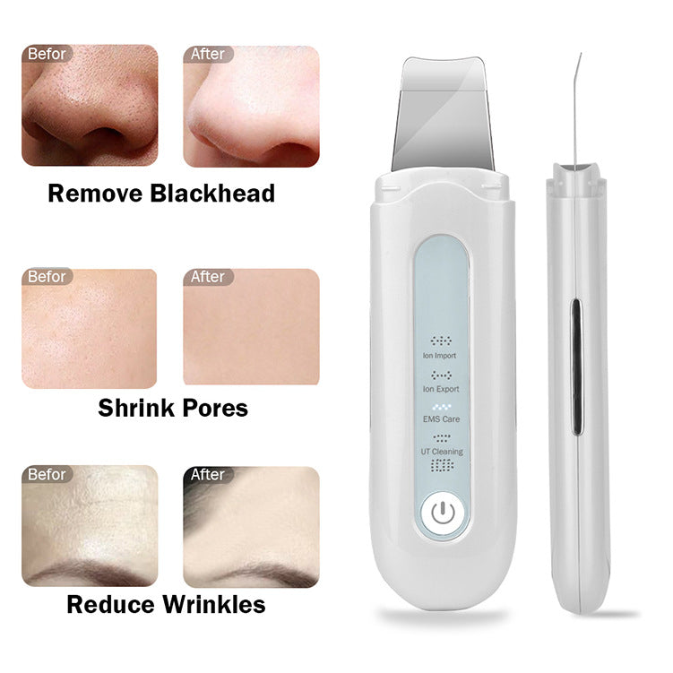 HailiCare New Ultrasonic Peeling Machine Pore Cleaner Horny Blackhead - V.I.P Digital Presence
