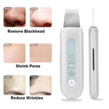 HailiCare New Ultrasonic Peeling Machine Pore Cleaner Horny Blackhead - V.I.P Digital Presence