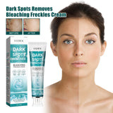 Crema blanqueadora para manchas que hidrata y humecta la piel para aclarar las manchas, crema de belleza para blanquear, iluminar y rejuvenecer la piel.