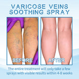Vein Treatment Spray, Relieve Leg Soreness And Swelling Repair Earthworm Leg Vein Treatment Spray - V.I.P Digital Presence