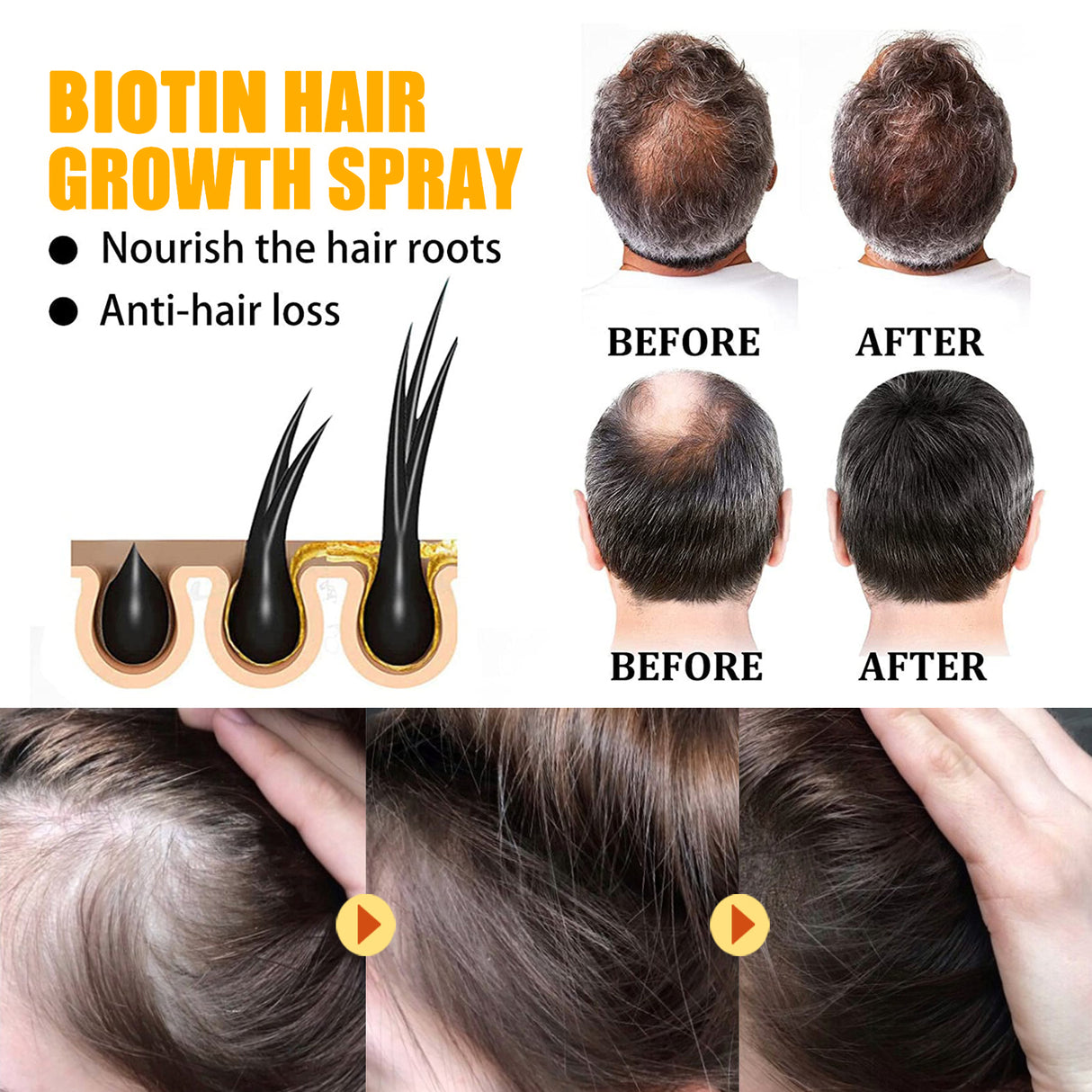 Biotin Hair Growth Spray, Strong Anti-Rip Repair Hair Care And Root Stabilization Spray - V.I.P Digital Presence