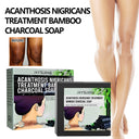 Underarm Whitening Soap, Clean And Repair Dark Skin Acanthosis Nigricans Moisturizing Whitening Beauty Soap - V.I.P Digital Presence