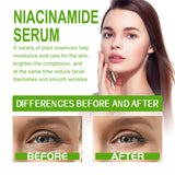 Crema facial en gel que aclara manchas y líneas finas, repara enrojecimiento y poros delicados, crema facial hidratante suave.