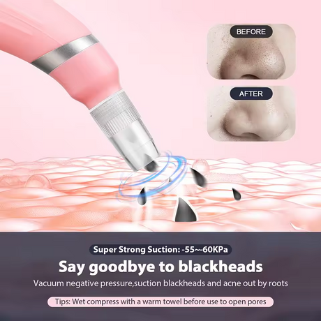 Diamond micro carving pore cleaner removes dead skin with high suction microcrystalline skin rejuvenation beauty device - V.I.P Digital Presence