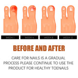 Anti-Nail Groove Relief Oil, Repair Inlaid Nails Gray Nails And Soft Thickening Nail Brightening Nails Care Oil - V.I.P Digital Presence