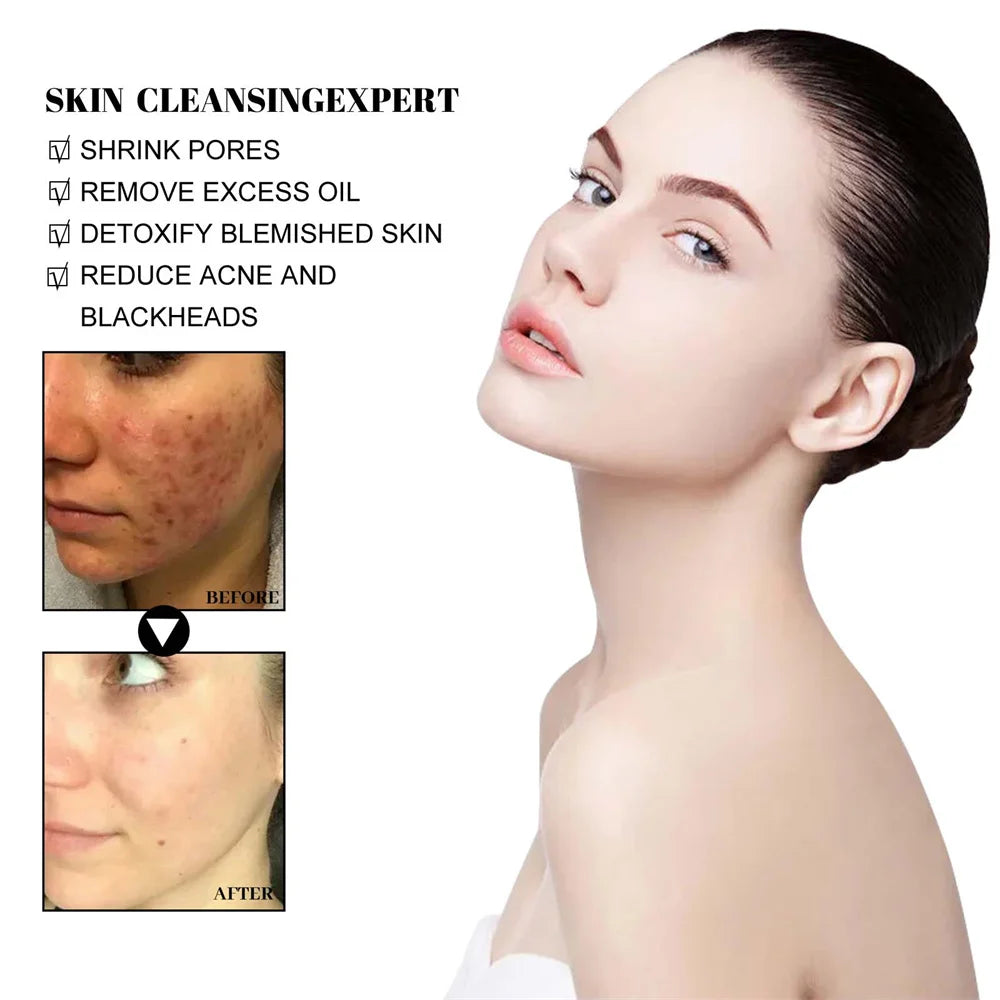 West & Month Blackhead Remove Solid Mud Film Refreshing Skin Cleaning Face Mask Moisturize Control Oil Shrink Pores Skin Care - V.I.P Digital Presence