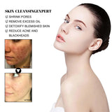 West & Month Blackhead Remove Solid Mud Film Refreshing Skin Cleaning Face Mask Moisturize Control Oil Shrink Pores Skin Care - V.I.P Digital Presence