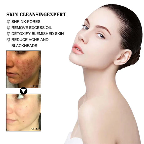 West & Month Blackhead Remove Solid Mud Film Refreshing Skin Cleaning Face Mask Moisturize Control Oil Shrink Pores Skin Care - V.I.P Digital Presence