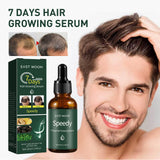 7 Days Essence Gently Moisturizes Hydrating Hairline Scalp Root Nourishing Hair Care Essential Oil - V.I.P Digital Presence