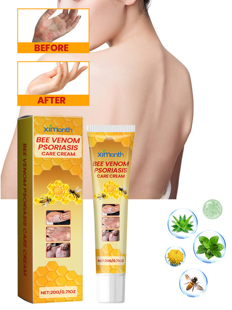 Bee-Poison Cowhide Moss Cream, Which Relieves Redness And Itchiness Of Skin - V.I.P Digital Presence