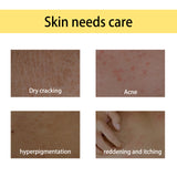 Handcrafted Body Oil, Moisturizing And Hydrating Massage Essential Oil For Soothing Tired Skin - V.I.P Digital Presence