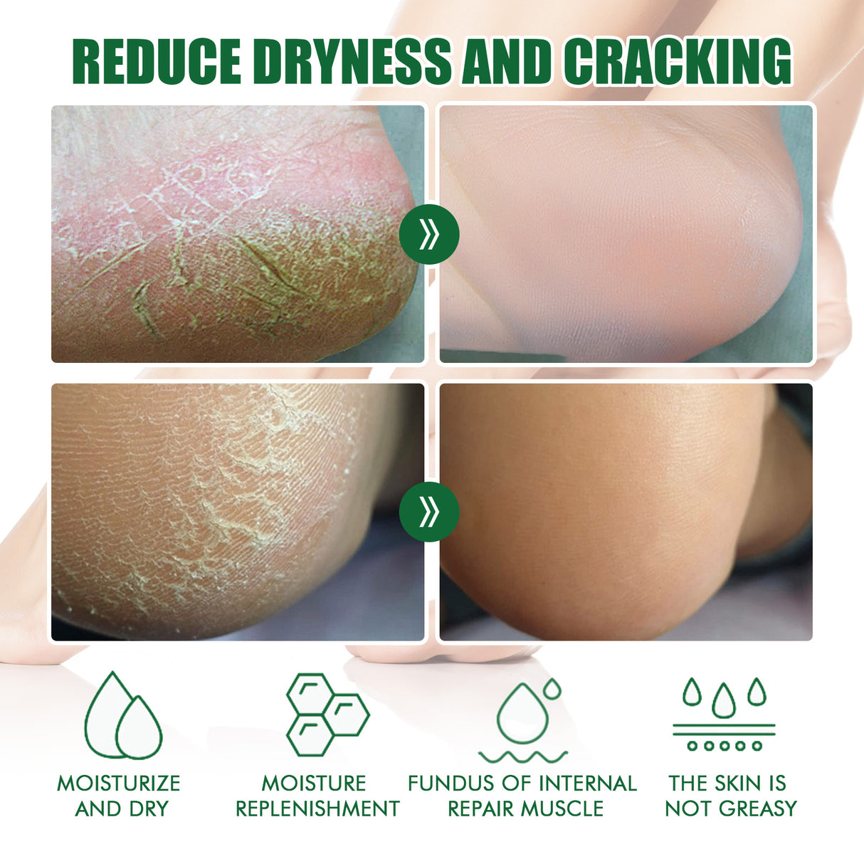Crema para talones agrietados, reparadora, exfoliante, antiagrietante e hidratante.