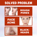Pore Minimizer Serum, Pore Minimizer Moisture To Deep Clean Pores Carry Bright Moisturizing Essence Serum