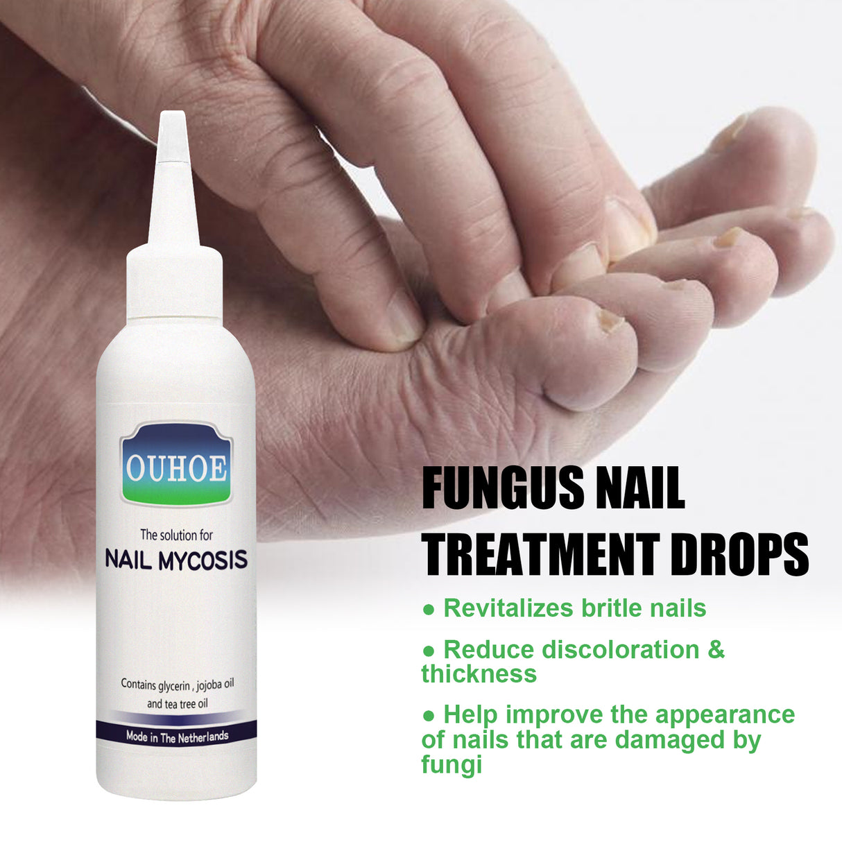 Gray Nail Repair Drops, Repair Hand And Foot Gray Nails Soft And Bright Nail Thickening Nail Care Solution - V.I.P Digital Presence