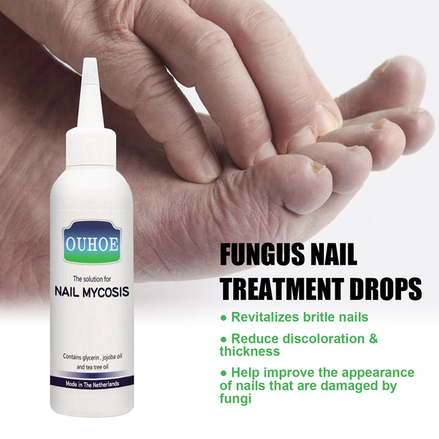 Gray Nail Repair Drops, Repair Hand And Foot Gray Nails Soft And Bright Nail Thickening Nail Care Solution - V.I.P Digital Presence