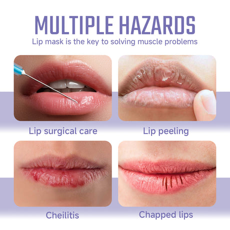 Ouhoe Collagen Lip Mask Repair Lip Lines, Remove Dead Skin, Prevent Dry And Crack, Moisturize And Care Lip Mask - V.I.P Digital Presence