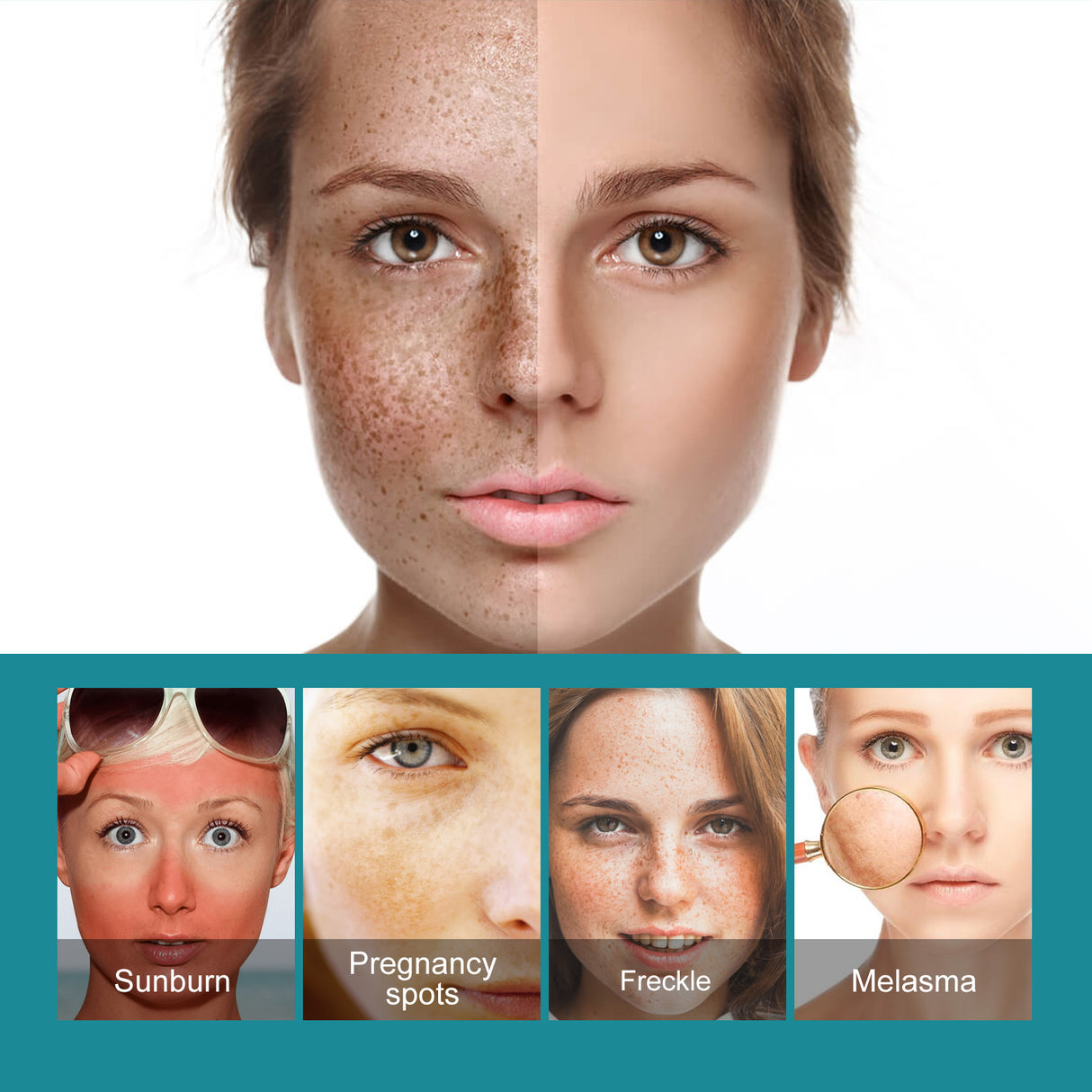 Crema blanqueadora para manchas que hidrata y humecta la piel para aclarar las manchas, crema de belleza para blanquear, iluminar y rejuvenecer la piel.