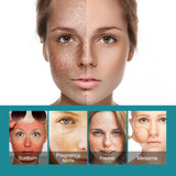 Crema blanqueadora para manchas que hidrata y humecta la piel para aclarar las manchas, crema de belleza para blanquear, iluminar y rejuvenecer la piel.