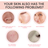 Foundation Serum, Lighten Acne Fine Lines And Dark Spots Moisturize Tender Skin Even Skin Tone Concealer Anti-Aging - V.I.P Digital Presence