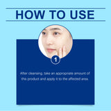 Retinol Gel Gently Cleanses Face Acne Care And Improves Skin Gel - V.I.P Digital Presence