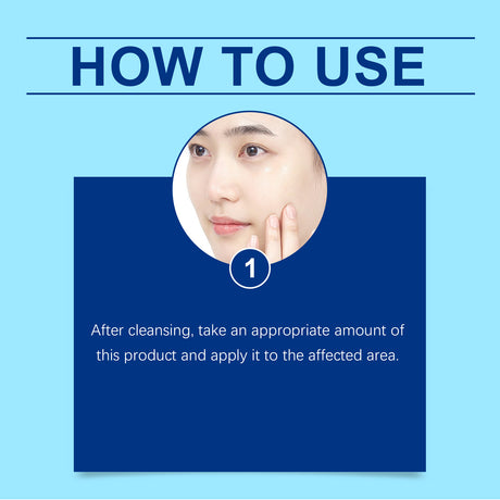 Retinol Gel Gently Cleanses Face Acne Care And Improves Skin Gel - V.I.P Digital Presence