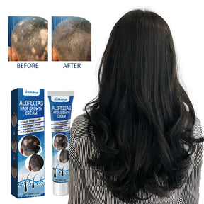 Alopecias Hair Growth Cream, Protect Hair Follicles Strong Moisturizing Thick Hairline Hair - V.I.P Digital Presence