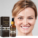 Facial Essence Moisturizes, Tightens, Softens, And Lightens Fine Lines - V.I.P Digital Presence