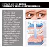 Parche de gel de aloe vera para ojos: reduce las líneas finas y las ojeras, reafirma los ojos y es antiarrugas e hidratante.